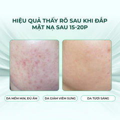 Mặt nạ Keyshu Rau Má – Làm dịu & phục hồi da nhạy cảm, cấp ẩm và tái tạo tự nhiên