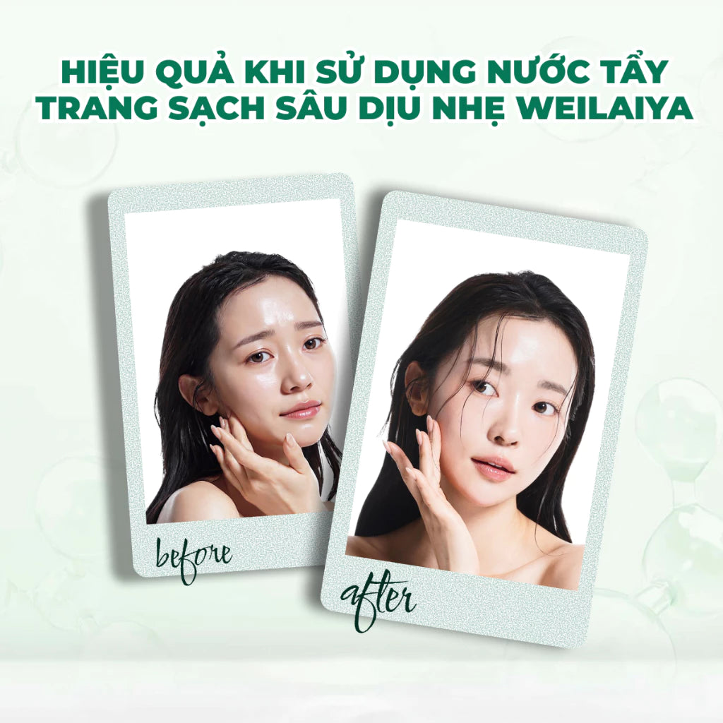 Nước tẩy trang dưỡng ẩm Weilaiya – Làm sạch sâu & phục hồi độ ẩm tự nhiên cho da