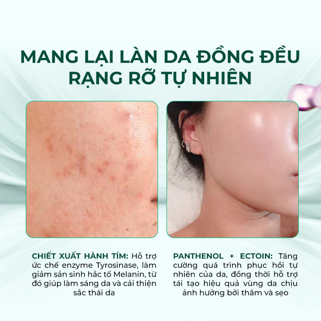 Mặt nạ Keyshu sợi xơ Hành Tím – Giúp giảm sẹo, mờ thâm & dưỡng ẩm chuyên sâu