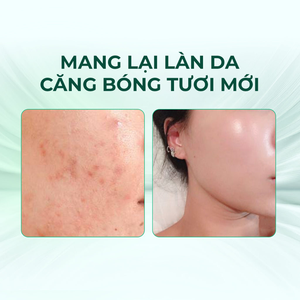 Mặt nạ Keyshu Nâng cơ – Giúp da săn chắc, giảm nếp nhăn & phục hồi độ đàn hồi tự nhiên