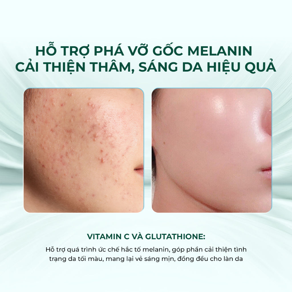 Mặt nạ Keyshu Vitamin C – Cấp ẩm & dưỡng trắng tự nhiên, phục hồi làn da rạng rỡ