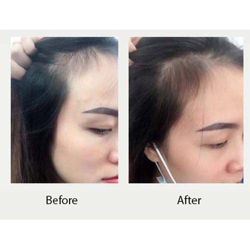Dầu gội Weilaiya Gừng Hà Thủ Ô – Dưỡng đen & kích thích mọc tóc