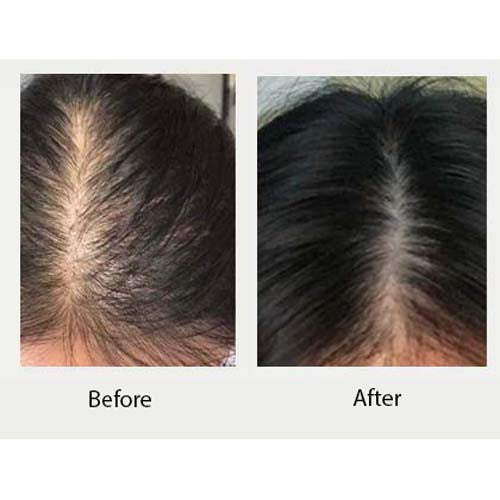 Dầu gội thảo dược Weilaiya Gừng Vân Nam – Làm sạch dịu nhẹ, giảm gãy rụng & kích thích mọc tóc
